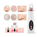 Removedor de Cravos a Vácuo Recarregável – SkinClear Pro