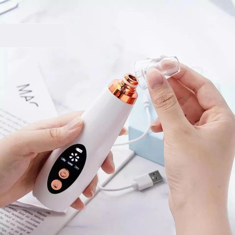 Removedor de Cravos a Vácuo Recarregável – SkinClear Pro