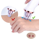 Removedor de Cravos a Vácuo Recarregável – SkinClear Pro